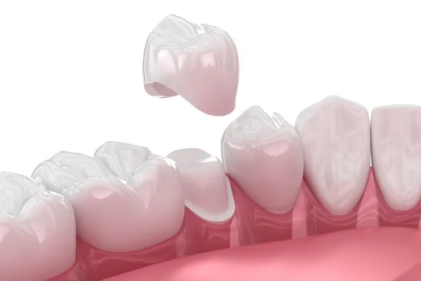dental treatment 05